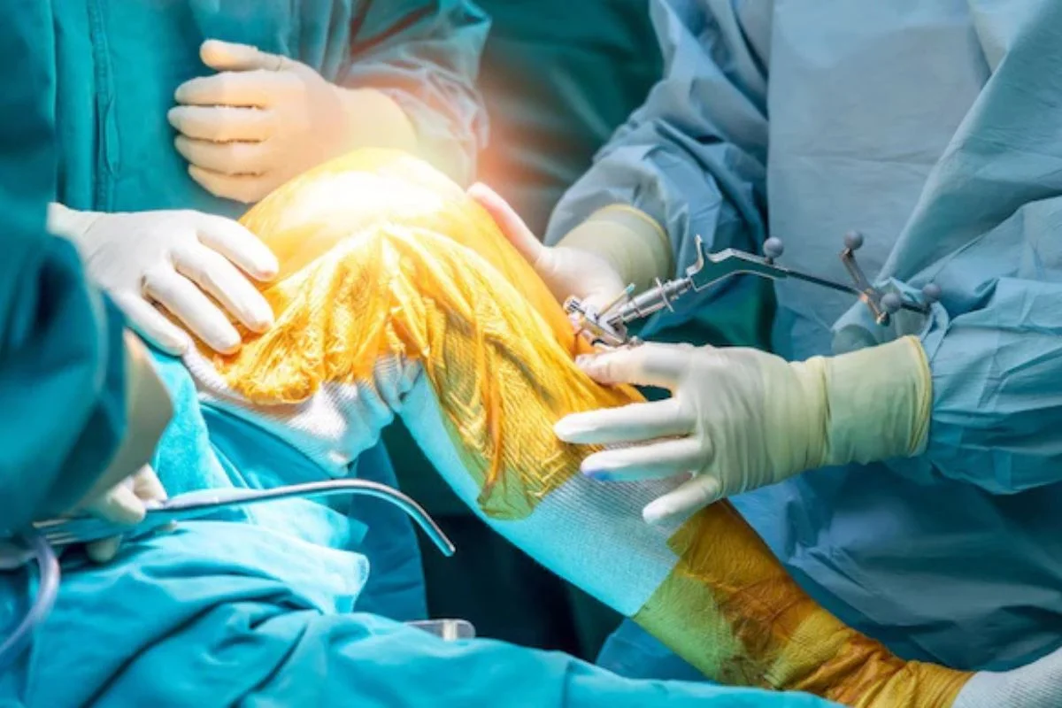 Knee Replacement in Nigeria