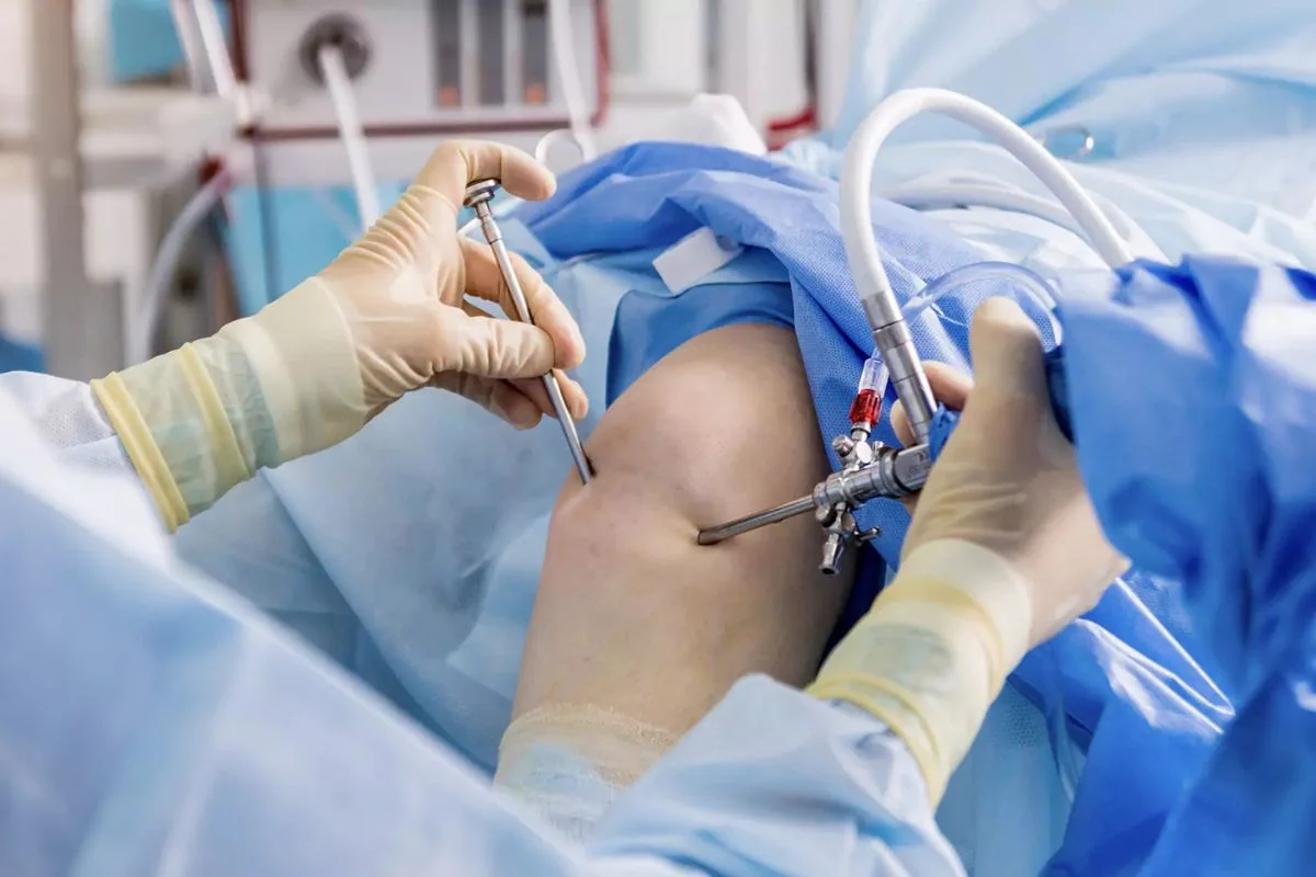 Ligament Reconstruction