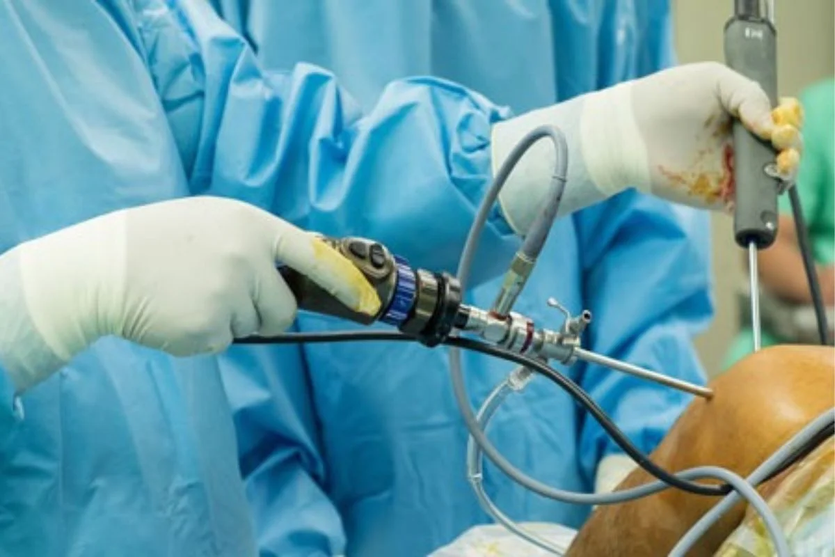 Shoulder Arthroscopy & Rotator Cuff Repair